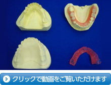 増歯、維持装置修理